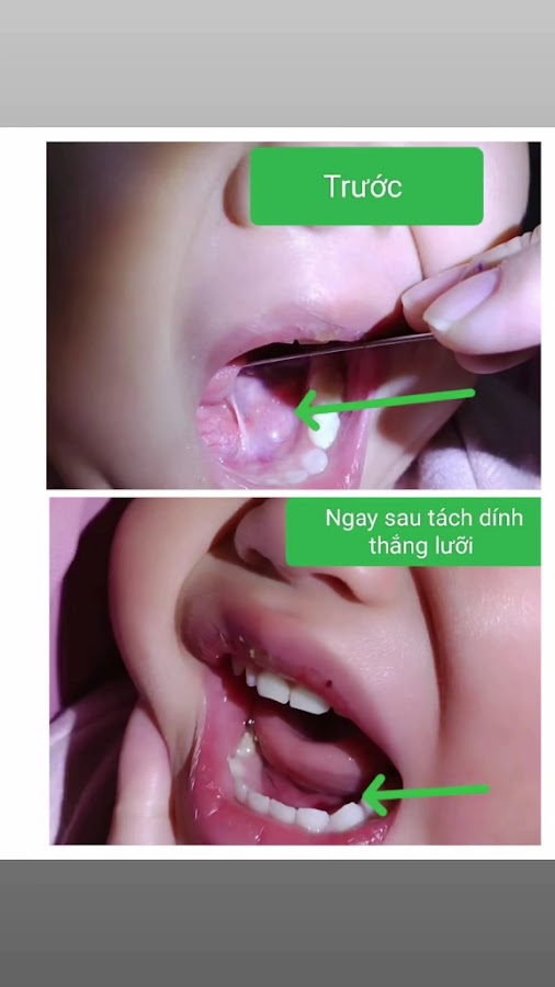 Phòng khám Tai Mũi Họng 79 _huyện Mê Linh, Hà Nội
