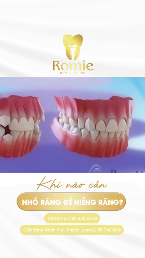 Nha Khoa Romie - Nha khoa uy tín Quận 9 - Bác sĩ tốt nghiệp chính quy Đại học Y dược TPHCM