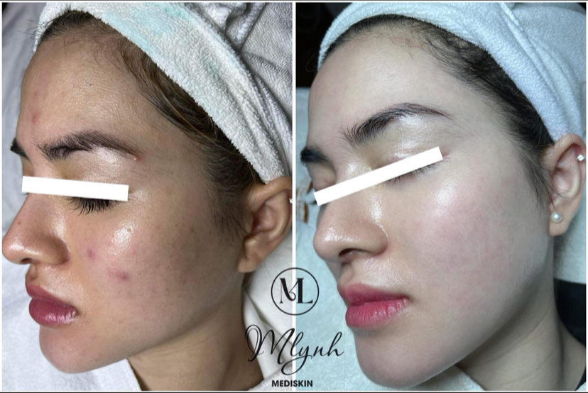 Mlynh Mediskin Spa