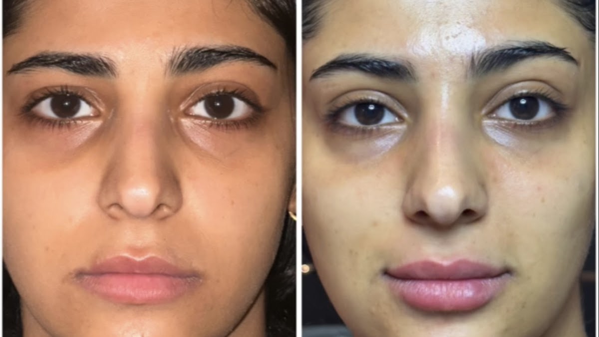 Hbio Clinic - Facial Skincare & Aesthetics