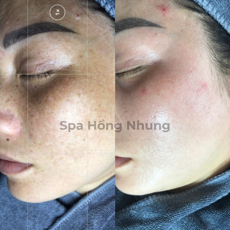 LaPo Spa&Beauty