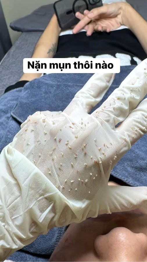 Gami Home Spa - Nặn Mụn Bằng Tay & Chăm Sóc Da Mụn Uy Tín Gò Vấp HCM